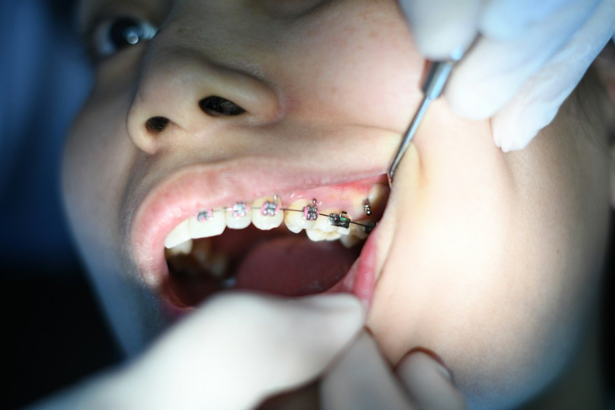 Comfort-focused dental care at Happy Family Dental Clinic