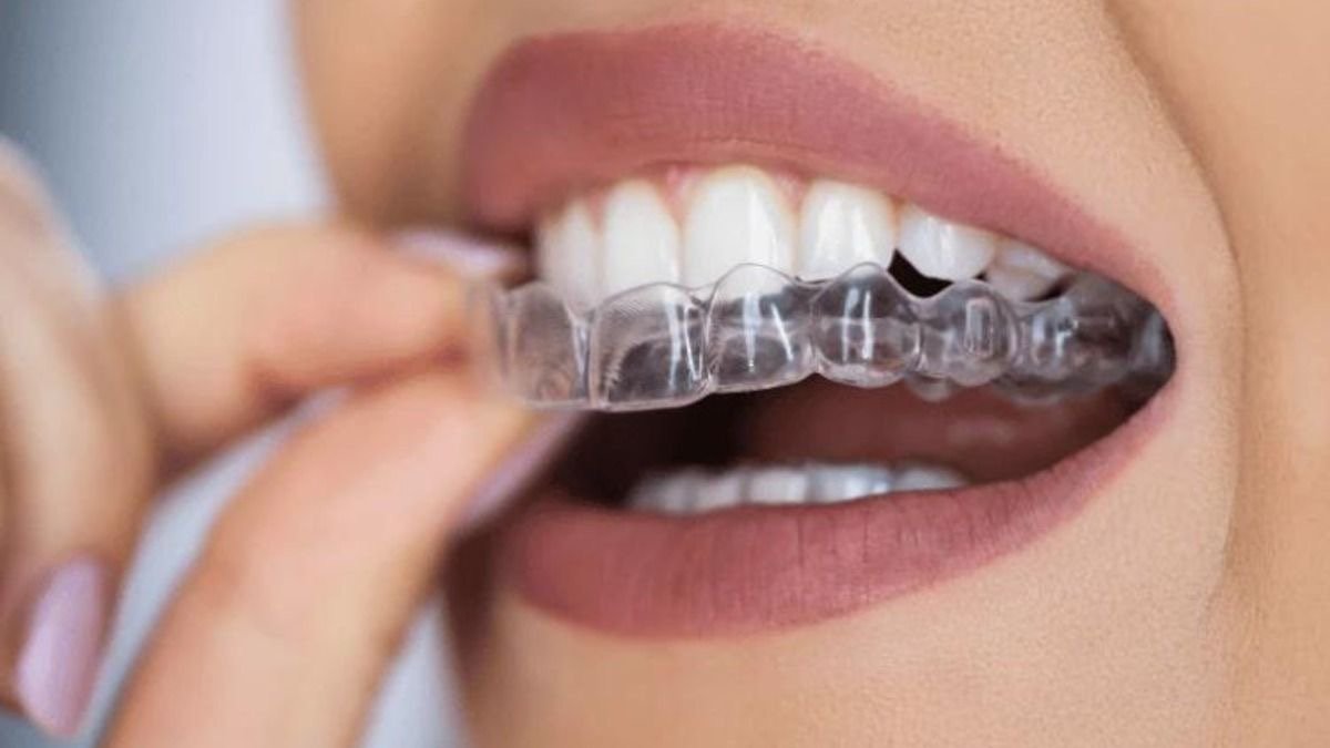 Clear aligners and braces treatment choices